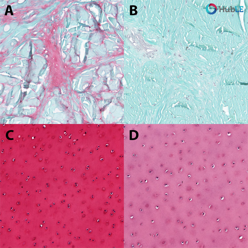 Cartilage glycosaminoglycans